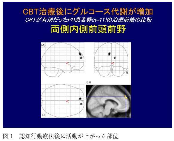【中古】 心理療法の交差点 精神分析・認知行動療法・家族療法・ナラティヴセラピ/新曜社/岡昌之 心理療法の交差点―精神分析・認知行動療法・家族療法
